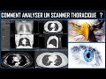 Comment analyser un scanner thoracique 