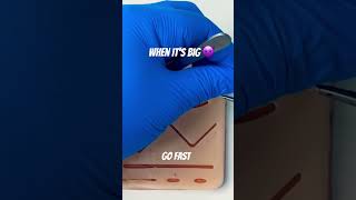 The Fast way to close a BIG wound #medicalstudent #doctor #plasticsurgeon #suture #nurse #meded #ed