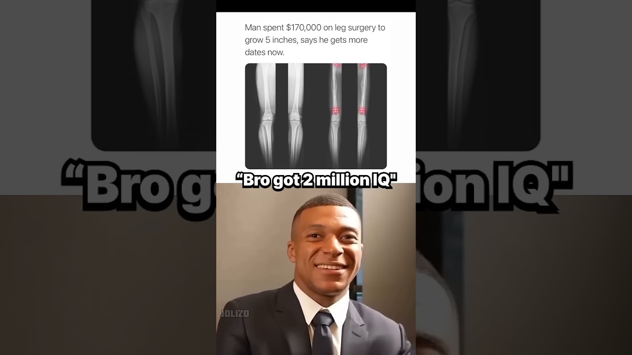 Bro Used 101 Of His Brain 