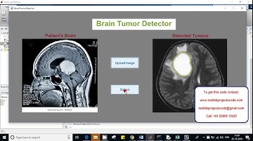 Brain tumor segmentation from MRI CT images