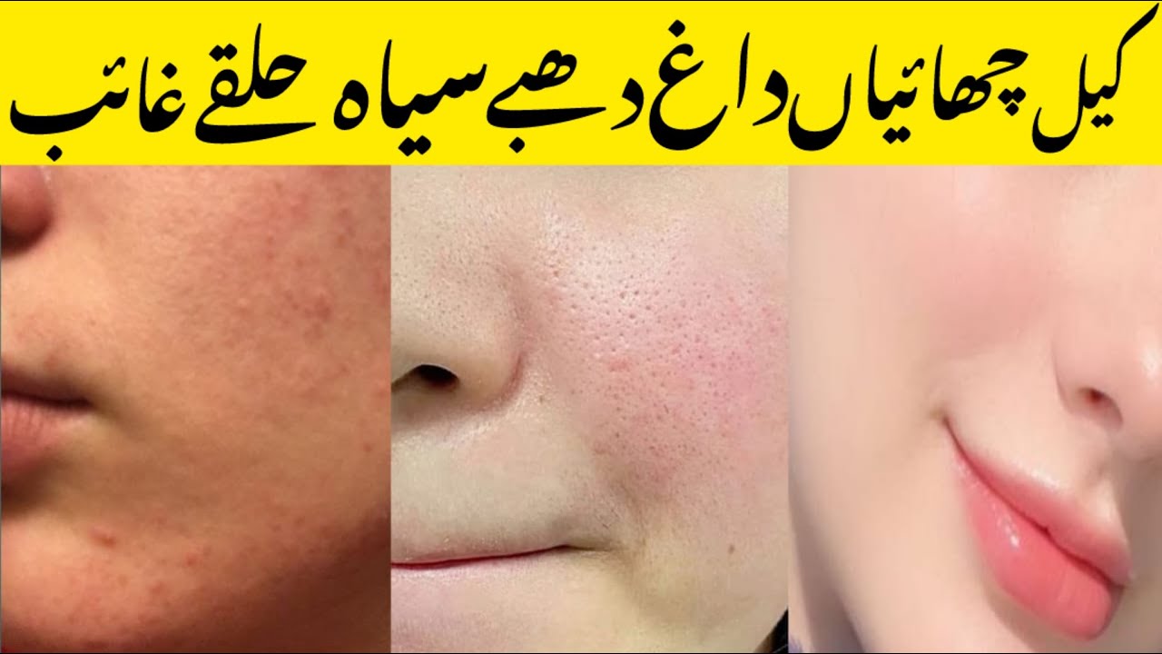 Faiza beauty cream review | Faiza beauty cream |  Faiza beauty cream how to use