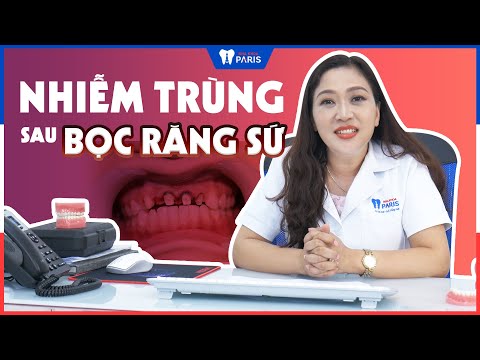 Dấu hiệu nhận biết nhiễm trùng sau khi bọc răng sứ