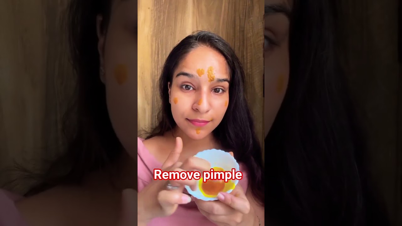 remove pimple at home remedy