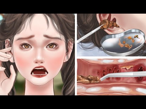 ASMR｜Be careful when picking the fruit! Remove bees from your ears! It's horrible｜That looks painful