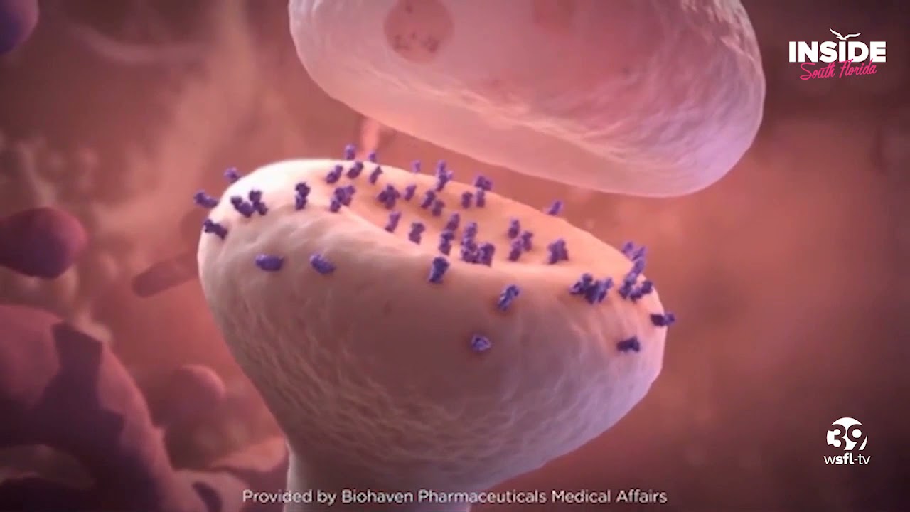 Dr. Katherine Standley on WSFL - Migraine