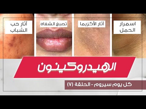 الهيدروكينون أكثر مادة فعالة للتبييض وتوحيد اللون وإزالة التصبغات والآثار القديمة