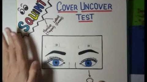 Types of squint and Cover uncover test