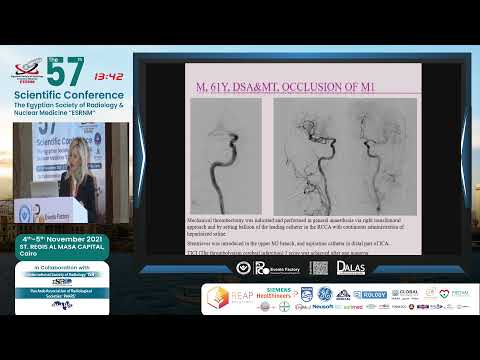 Radiological Diagnostics And Endovascular Treatment of Stroke