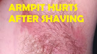 why do my armpits hurt after shaving