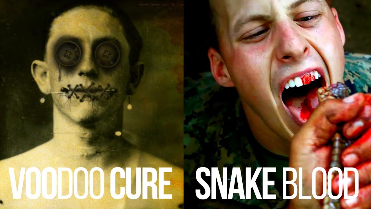 Top 10 Bizarre Health and Wellness Practices Around the World