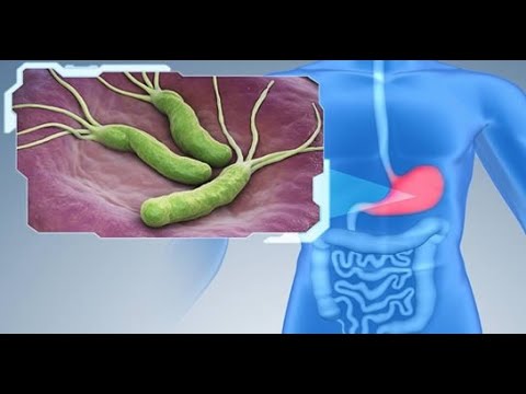 Video: Dieta Pentru Helicobacter Pylori - Ce Se Poate și Nu Se Poate Mânca?