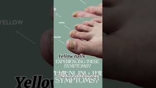 These are not skin problems they r signal from ur nerves.circulation✨ #nerves#tingling#yt #ytshorts