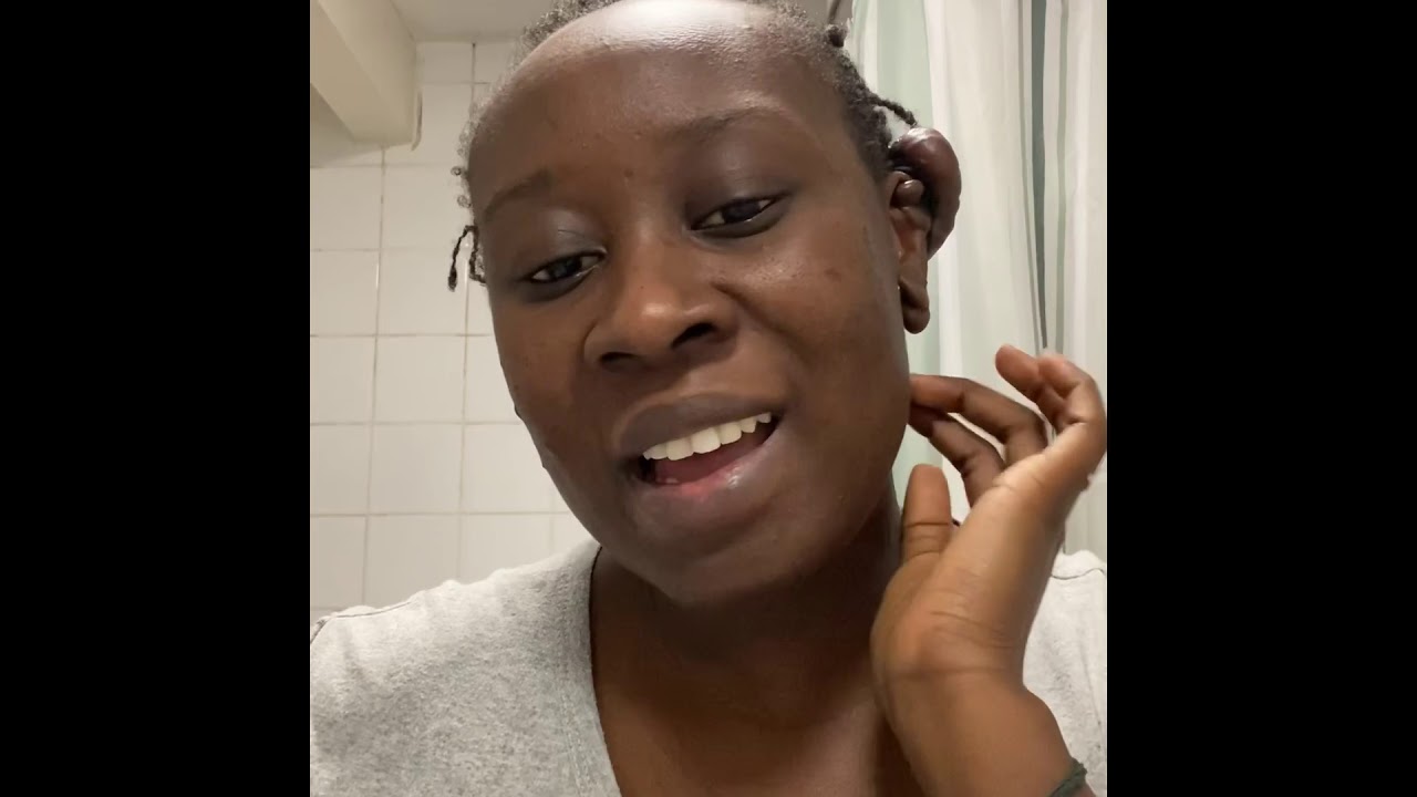 Keloid removal with rubber bands day 4,5&6 YouTube