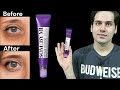 Some by mi  retinol intense advanced triple action eye cream review