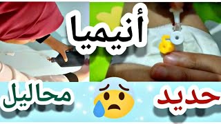 ازاي تعلق المحلول في المنزل/ الحديد للأنيميا