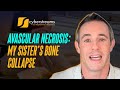 System Update #325: Avascular Necrosis: My Sister’s Bone Collapse
