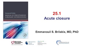 25.1 Manual of PCI - Acute vessel closure