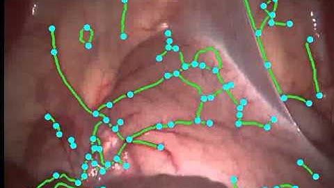 ISBI 2014 supplemental video