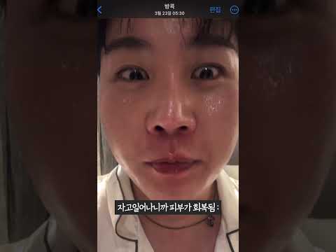 광고❌ 와... 피부과 화장품 진짜 좋구나... (+여행 가자마자 피부가 썩었던 SSUL) #shorts