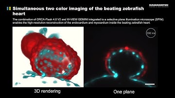 Simultaneous two color imaging of the beating zebrafish heart