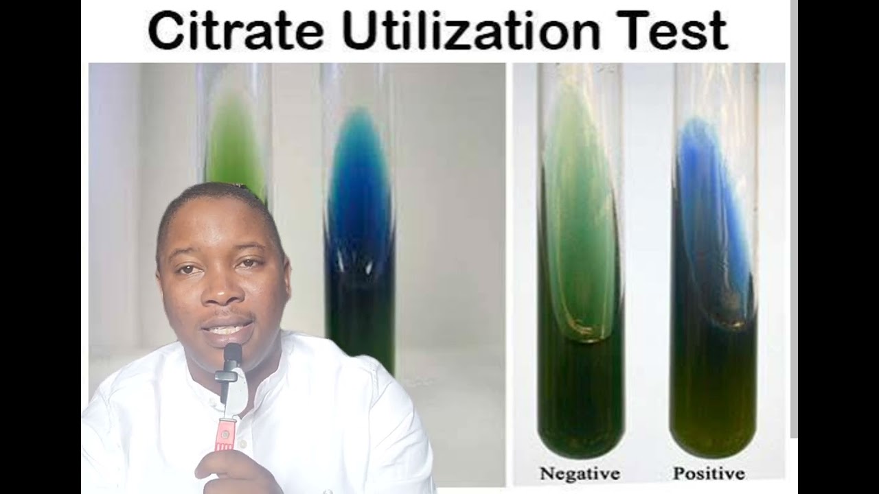 Citrate Utilization Test