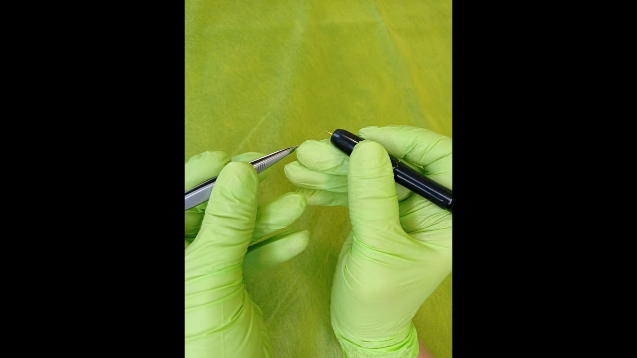 Видео электроэпиляция подмышек Харьков - YouTube