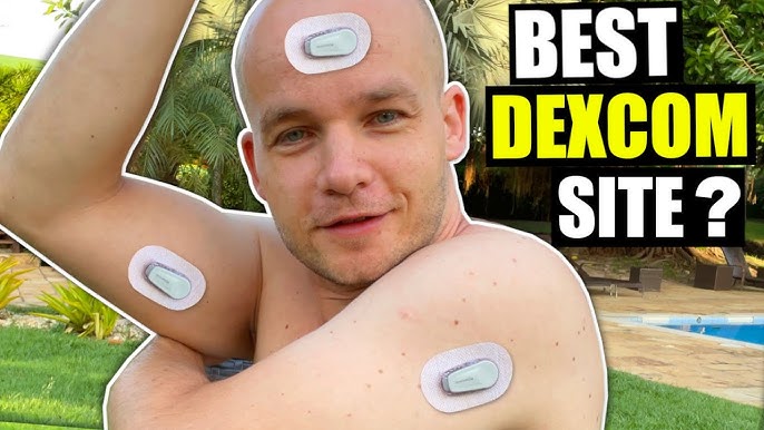 Dexcom G6 sensors not sticking to skin? : r/Type1Diabetes