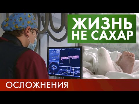 Осложнения диабета | Жизнь не сахар #14 (2019)