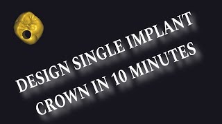 Design single screw retained implant crown in 10 minutes