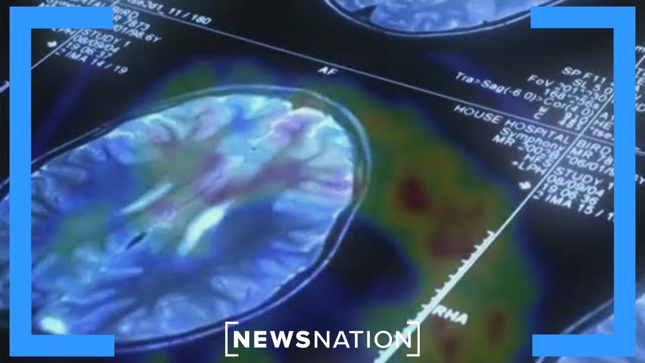 How does Donanemab compare to other Alzheimer's drugs? | Morning in America