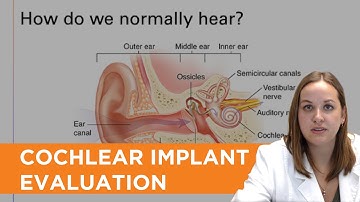 What to Expect at your Cochlear Implant Candidacy Evaluation (captioned)