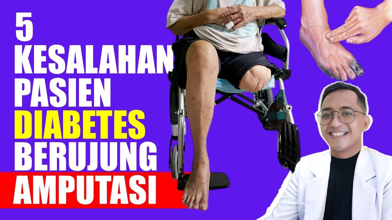 5 Kesalahan Pasien Diabetes yang Berujung Amputasi