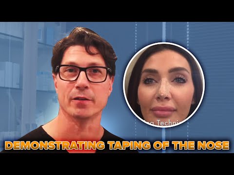 Video thumbnail: Dr. Jay Calvert Rhinoplasty Expert, demonstrating taping of the nose