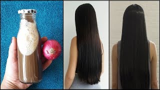 Onion Shampoo: Onion Shampoo For Hair Growth | Baal Badhane Ka Tarika