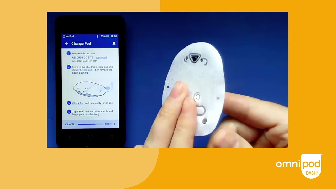 Omnipod dash show and tell youtube