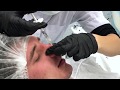 Тренинг | Анатомия лица | Контурная пластика носа | Илья Шаров