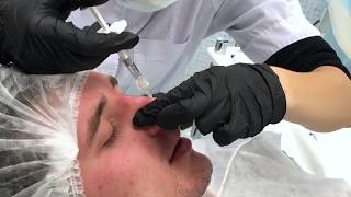 Тренинг | Анатомия лица | Контурная пластика носа | Илья Шаров Тренинг | Анатомия лица | Контурная пластика носа | Илья Шаров