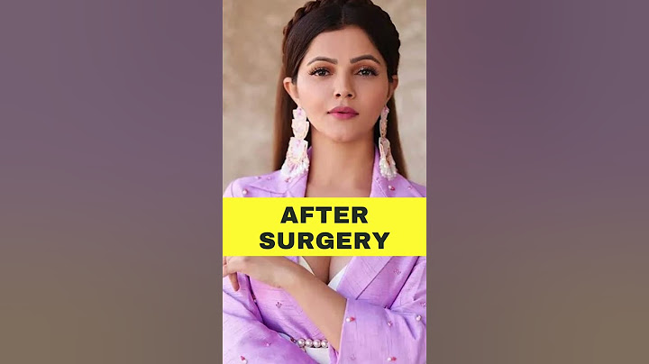 Rubina Dilaik Before And After Plastic Surgery😱 | Entertainment News | Her Zindagi