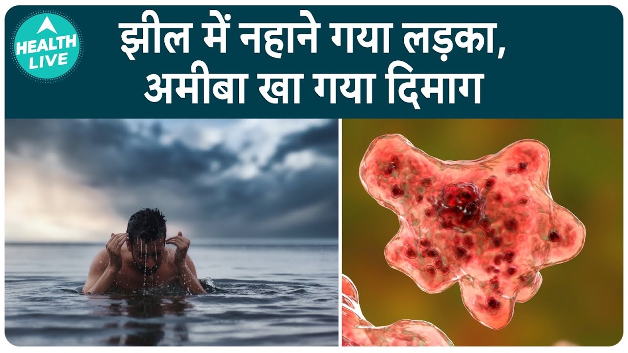 Kerala: 15-Year-Old Boy Dies Due To Rare Brain Infection Caused By Free-Living Amoeba