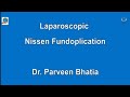 Laparoscopic Nissen Fundoplication for Hiatus Hernia repair-step by step by Dr.Parveen Bhatia