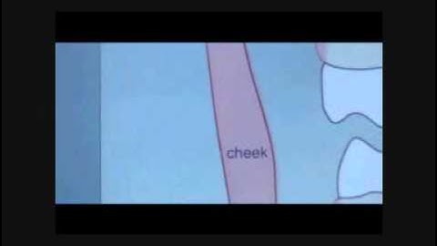 Correct Tooth Contact