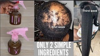 EFFECTIVE HERBAL HAIR GROWTH TREATMENT TO GROW BALDNESS ALOPECIA SHEDDING 3 TIMES UNSTOPPABLE FASTER