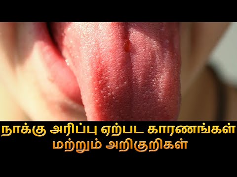 நாக்கு அரிப்பு ஏற்பட காரணங்கள் மற்றும் அறிகுறிகள் | Tongue Health Tips in Tamil | D J Tamil