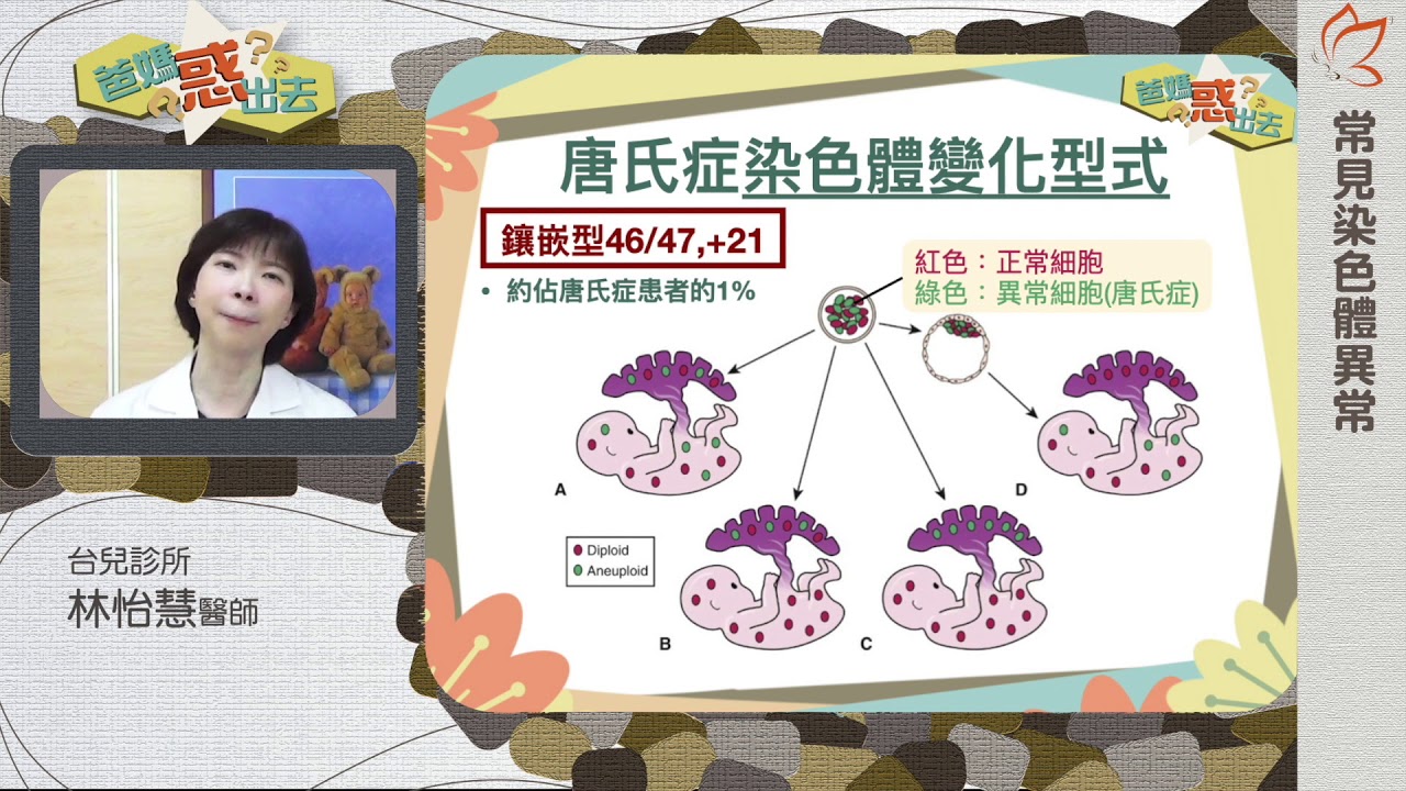常見染色體異常05：唐氏症－鑲嵌型與轉位型（林怡慧醫師）