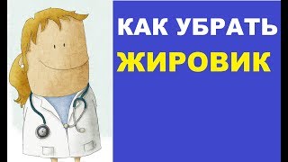 Как убрать жировик в домашних условиях?