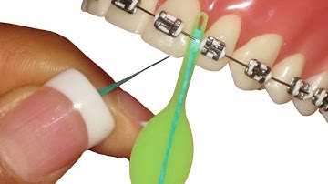 How does the flossfish compare against other devices on the market?