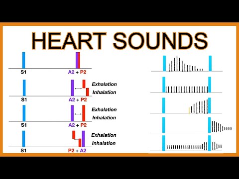 Heart Sounds (Murmurs and Splitting)