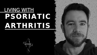 Living with Psoriatic Arthritis  Symptoms, Diagnosis, Impact on your life & Treatment