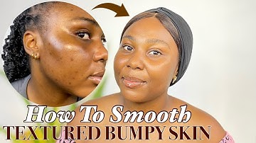 How To Get Rid Of Textured Skin: A Skincare Routine For A Smooth And Glowing Complexion!