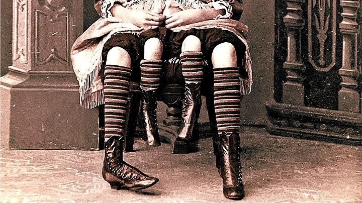 The Story of Myrtle Corbin, the Real Life Four Leg...